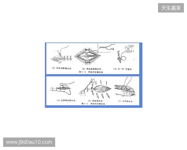 广州豹官方:杨浩眉弓伤口缝合30余针,预计5-7天后拆线 广州豹官方:杨浩眉弓伤口缝合30余针,预计5-7天后拆线